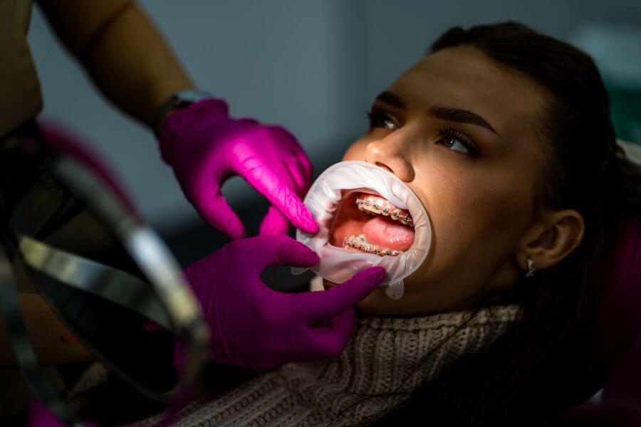 Aparat dentar Cluj, gutiere dentare Invisalign ortodontie
