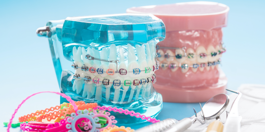 aparat dentar Cluj, aparat dentar safir Cluj