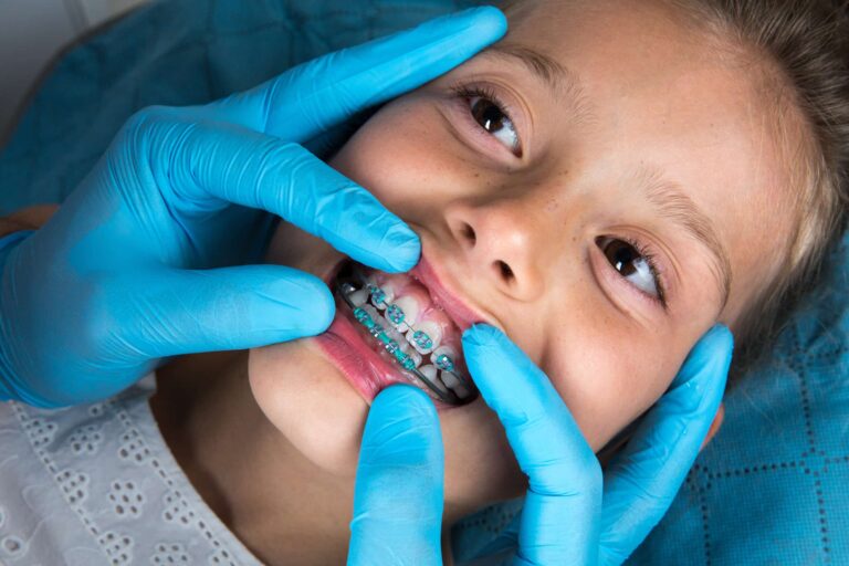 Tratament ortodontic cu aparat dentar la Cluj-Napoca, clinica Nest Dental